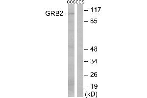 Immunohistochemistry analysis of paraffin-embedded human colon carcinoma tissue using GRB2 (Ab-159) antibody. (GAB2 Antikörper  (Ser159))