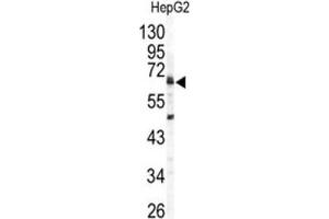 Western Blotting (WB) image for anti-Arylsulfatase B (ARSB) antibody (ABIN3003229) (Arylsulfatase B Antikörper)