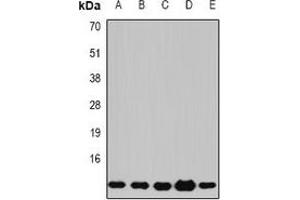 Western blot analysis of Beta 2 Microglobulin expression in Jurkat (A), COS7 (B), K562 (C), mouse lung (D), mouse liver (E) whole cell lysates. (beta-2 Microglobulin Antikörper)