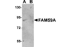 Western Blotting (WB) image for anti-Family with Sequence Similarity 59, Member A (FAM59A) (C-Term) antibody (ABIN1030387) (FAM59A Antikörper  (C-Term))