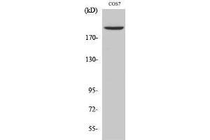 Western Blotting (WB) image for anti-Topo IIalpha (N-Term) antibody (ABIN3187305) (Topo IIalpha (N-Term) Antikörper)