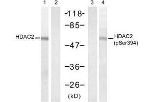Western blot analysis of extracts from HT-29 cells untreated or treated with UV (20min), using HDAC2 (Ab-394) antibody (E021140, Lane 1 and 2) and HDAC2 (Phospho-Ser394) antibody (E011191, Lane 3 and 4). (HDAC2 Antikörper  (pSer394))