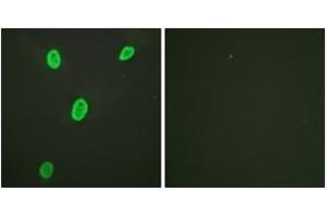 Immunofluorescence analysis of HeLa cells, using Histone H4 (Acetyl-Lys12) Antibody. (Histone H4 Antikörper  (acLys12))