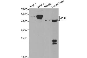 Western blot analysis of extracts of various cell lines, using FLI1 antibody. (FLI1 Antikörper)