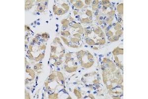 Immunohistochemistry of paraffin-embedded human stomach using PSPH antibody. (PSPH Antikörper  (AA 1-225))