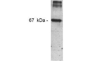 Western Blotting (WB) image for anti-Nitrotyrosine antibody (ABIN126845) (Nitrotyrosine Antikörper)