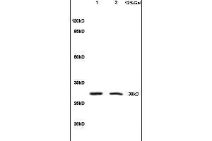 Formalin-fixed and paraffin embedded rat colitis tissue labeled with Anti-IL-1 Beta/IL-1B Polyclonal Antibody, Unconjugated (ABIN872644) at 1:200, followed by conjugation to the secondary antibody and DAB staining (IL-1 beta Antikörper  (AA 161-269))