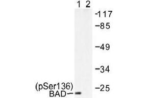 Image no. 1 for anti-BCL2-Associated Agonist of Cell Death (BAD) (pSer136), (pSer99) antibody (ABIN317969) (BAD Antikörper  (pSer99, pSer136))