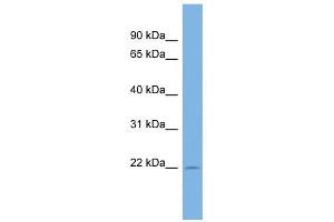 C13ORF28 antibody used at 1 ug/ml to detect target protein. (SPACA7 Antikörper  (Middle Region))