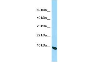 WB Suggested Anti-2410015M20Rik Antibody Titration: 1. (Chromosome 19 Open Reading Frame 70 (C19ORF70) (C-Term) Antikörper)