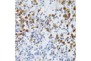 Immunohistochemistry of paraffin-embedded human tonsil using CHAF1B antibody (ABIN5973690) at dilution of 1/100 (40x lens). (CHAF1B Antikörper)