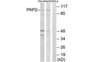Western Blotting (WB) image for anti-Plakophilin 2 (PKP2) (AA 632-681) antibody (ABIN2890508) (Plakophilin 2 Antikörper  (AA 632-681))