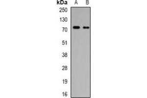 Western blot analysis of GalNAc-T3 expression in MCF7 (A), SW480 (B) whole cell lysates. (GALNT3 Antikörper)