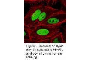 Image no. 3 for anti-Peroxisome Proliferator-Activated Receptor gamma (PPARG) antibody (ABIN232120) (PPARG Antikörper)