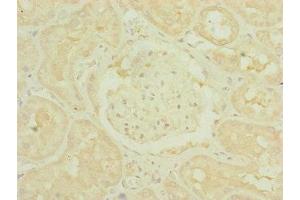 Immunohistochemistry of paraffin-embedded human kidney tissue using ABIN7159887 at dilution of 1:100 (TIMM1B (AA 1-103) Antikörper)