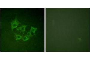 Immunofluorescence analysis of HuvEc cells, using COT (Phospho-Thr290) Antibody. (CROT Antikörper  (pThr290))