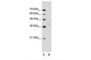 Image no. 1 for anti-Keratin 13 (KRT13) (C-Term) antibody (ABIN203408) (Cytokeratin 13 Antikörper  (C-Term))