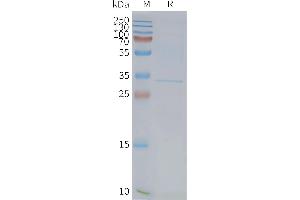 Human F-Nanodisc, Flag Tag on SDS-PAGE (FFAR1 Protein)