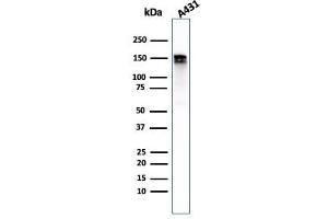 Western Blotting (WB) image for anti-Epidermal Growth Factor Receptor (EGFR) antibody (ABIN6939297)