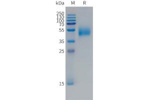 Human F(745-847)Protein, mFc Tag on SDS-PAGE under reducing condition. (FCRL5 Protein (AA 745-847) (mFc Tag))