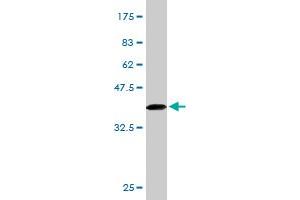 Western Blot detection against Immunogen (34. (IL23R Antikörper  (AA 553-628))