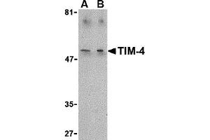 Western Blotting (WB) image for anti-T-Cell Immunoglobulin and Mucin Domain Containing 4 (TIMD4) (C-Term) antibody (ABIN1030736) (TIMD4 Antikörper  (C-Term))