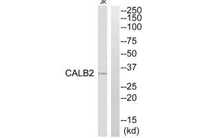 Western Blotting (WB) image for anti-Calbindin 2 (CALB2) (Internal Region) antibody (ABIN1850972) (Calretinin Antikörper  (Internal Region))