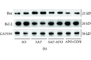 Western Blotting (WB) image for anti-B-Cell CLL/lymphoma 2 (BCL2) (N-Term) antibody (ABIN2857047)