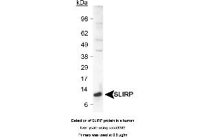 Image no. 1 for anti-SRA Stem-Loop Interacting RNA Binding Protein (SLIRP) (C-Term) antibody (ABIN363541) (SLIRP Antikörper  (C-Term))