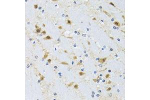 Immunohistochemistry of paraffin-embedded mouse brain using CCT4 antibody. (CCT4 Antikörper  (AA 130-390))