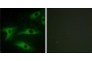 Immunofluorescence analysis of HeLa cells, using Collagen I alpha2 Antibody. (COL1A2 Antikörper  (AA 471-520))