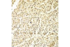 Immunohistochemistry (Paraffin-embedded Sections) (IHC (p)) image for anti-Lamin A/C (LMNA) (AA 403-572) antibody (ABIN3020785)