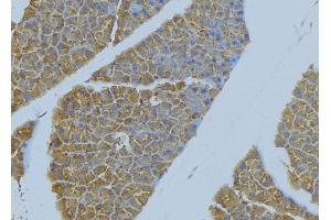 ABIN6277655 at 1/100 staining Human pancreas tissue by IHC-P. (ICAM1 Antikörper  (C-Term))