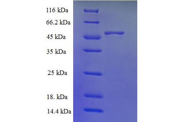 TMLHE Protein (AA 16-376) (His tag)