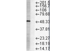 FKBP51 Western Blot. (FKBP5 Antikörper)