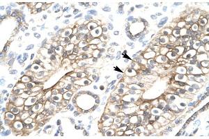 Human kidney (FLJ11730 (N-Term) Antikörper)