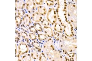 Immunohistochemistry of paraffin-embedded human kidney using IKZF1 antibody at dilution of 1:100 (x400 lens). (IKZF1 Antikörper)