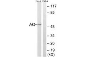 Western blot analysis of extracts from HeLa cells, using Akt (Ab-473) Antibody. (AKT1 Antikörper  (AA 431-480))