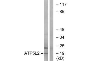 Western blot analysis of extracts from A549 cells, using ATP5L2 antibody. (ATP5L2 Antikörper  (Internal Region))