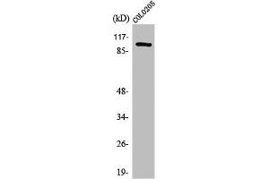 Western Blot analysis of COLO205 cells using Synphilin-1 Polyclonal Antibody (SNCAIP Antikörper  (C-Term))