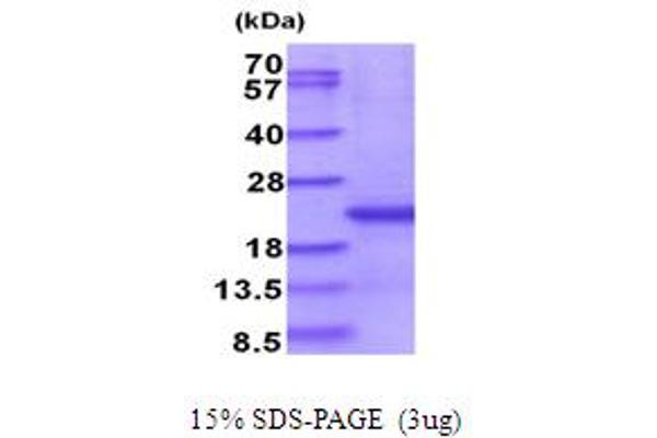 CD300E Protein (AA 18-173) (His tag)