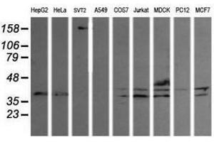 Image no. 1 for anti-Mitogen-Activated Protein Kinase Kinase 3 (MAP2K3) antibody (ABIN1499420) (MAP2K3 Antikörper)