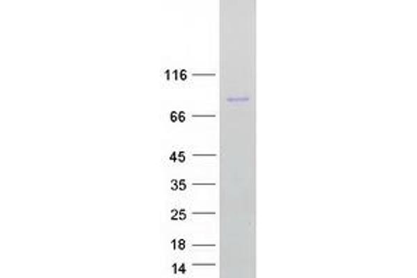 MFN2 Protein (Transcript Variant 2) (Myc-DYKDDDDK Tag)