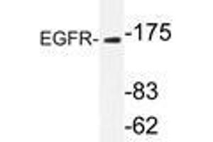 Western blot analysis of EGFR antibody in extracts from Jurkatcells. (EGFR Antikörper)