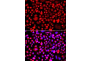 Immunofluorescence analysis of A549 cells using ALG1 antibody (ABIN5975731). (ALG1 Antikörper)