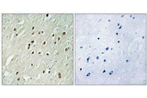 Immunohistochemistry (IHC) image for anti-Centrobin, Centrosomal BRCA2 Interacting Protein (CNTROB) (Internal Region) antibody (ABIN1851053) (CNTROB Antikörper  (Internal Region))
