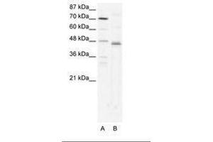 Image no. 1 for anti-Zfp-1 (AA 97-146) antibody (ABIN202318) (Zfp-1 Antikörper  (AA 97-146))