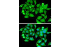 Immunofluorescence analysis of A549 cells using UBASH3B antibody. (UBASH3B Antikörper)