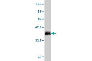 Western Blot detection against Immunogen (36. (CALCOCO2 Antikörper  (AA 347-446))