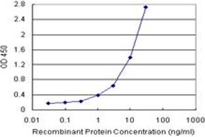 Sandwich ELISA detection sensitivity ranging from 0. (IRF2 (Human) Matched Antibody Pair)